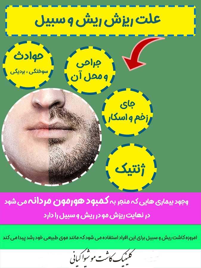 کاشت ریش و سبیل-مراحل کاشت ریش و سبیل-مراحل